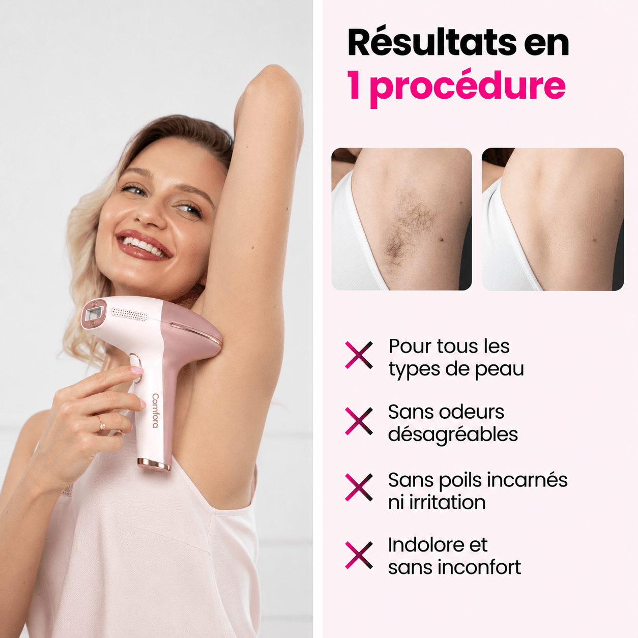 Comfora™ Kit Épilation IPL - comfora